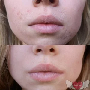 خرید ژل سیکاپلاست لاروش پوزای ترمیم کننده