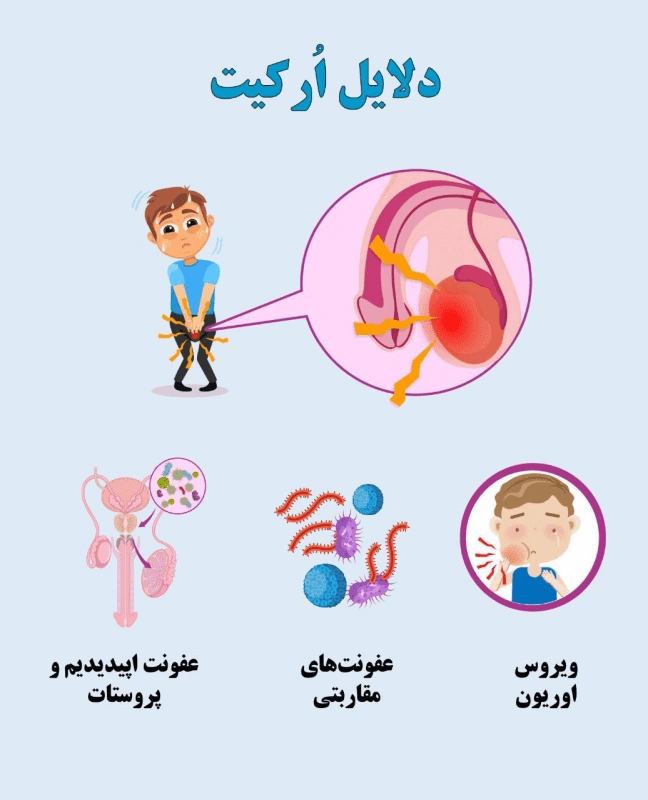 اورکیت (التهاب بیضه): علل، علائم و راه‌های درمان