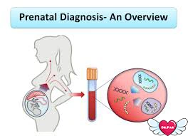 تشخیص قبل از تولد (Prenatal Diagnosis)