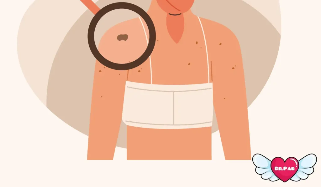 جوش باسن و بدن