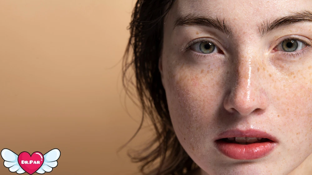 لک قهوه ای صورت