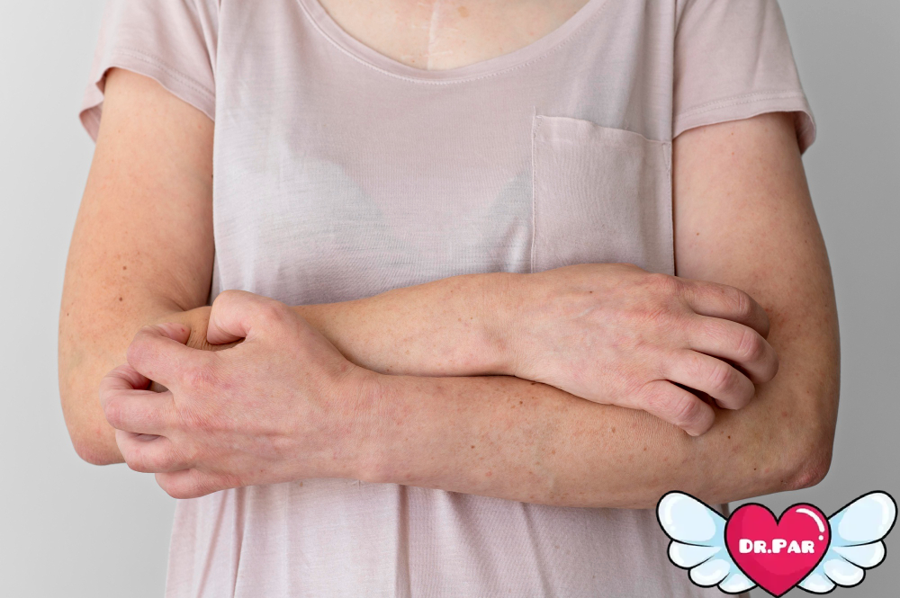 علائم و مدت زمان کهیر مزمن