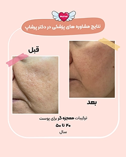before-after-anti-aging-wrinkle-rejuvenation