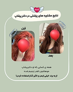قبل و بعد از درمان ترمیم مو