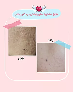 نتایج مشاوره پزشکی دکتر پرشاپ
