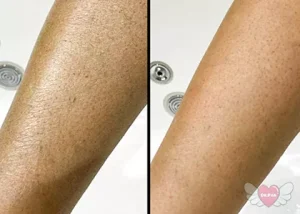 پک درمان پوست مرغی ژنو بایوتیک