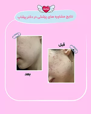 نتایج مشاوره پزشکی دکتر پرشاپ