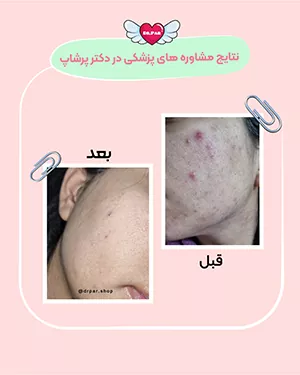 نتایج مشاوره پزشکی دکتر پرشاپ