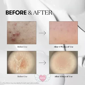 تمایز اسپات ژل ضد جوش برایت مکس