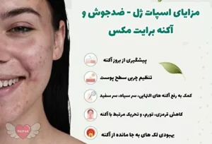 ژل ضد جوش برایت مکس مدل آکنه برایت