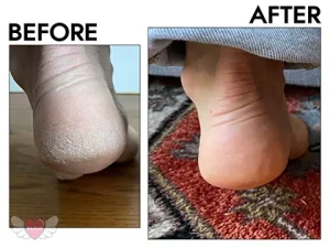 حرید اسکراب پا ژنو بایوتیک