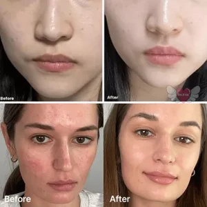 پد تونر روشن کننده و ضدلک ویتامین سی مدیکیوب