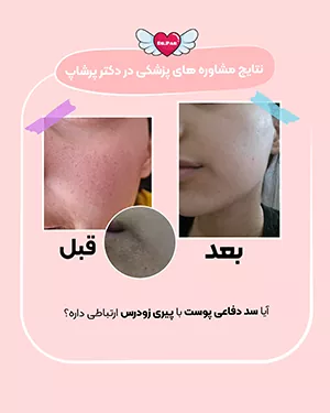 نتایج مشاوره پزشکی دکتر پرشاپ جوانسازی